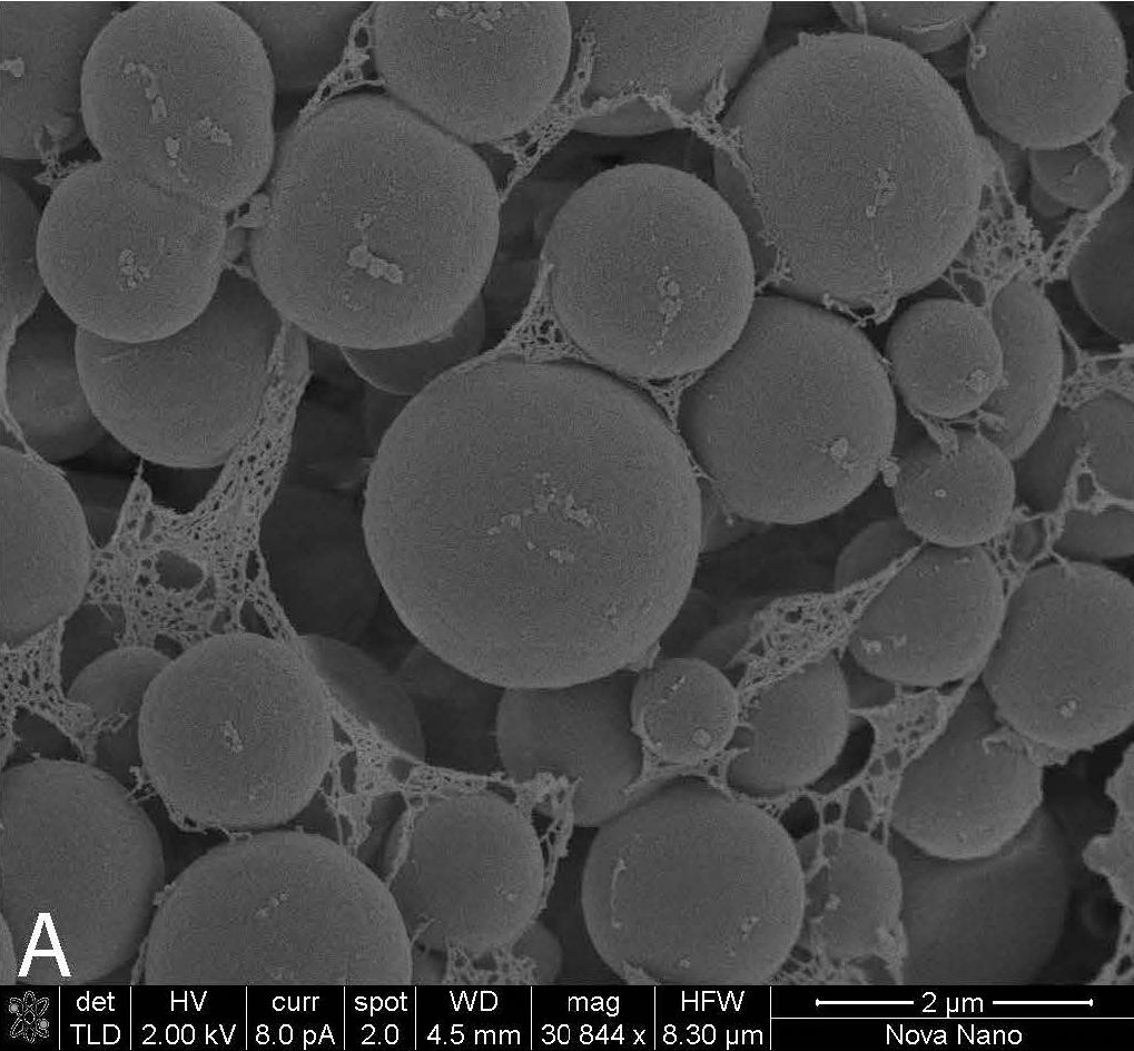 Methanohalophilus%20Krebit%20Deep%20Guan%202019%20cropped%20fmicb 10-00839-g001